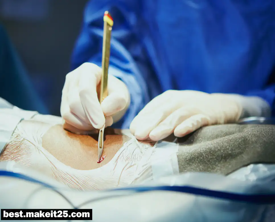 의학용어 I&D, AMI, AV, AVM