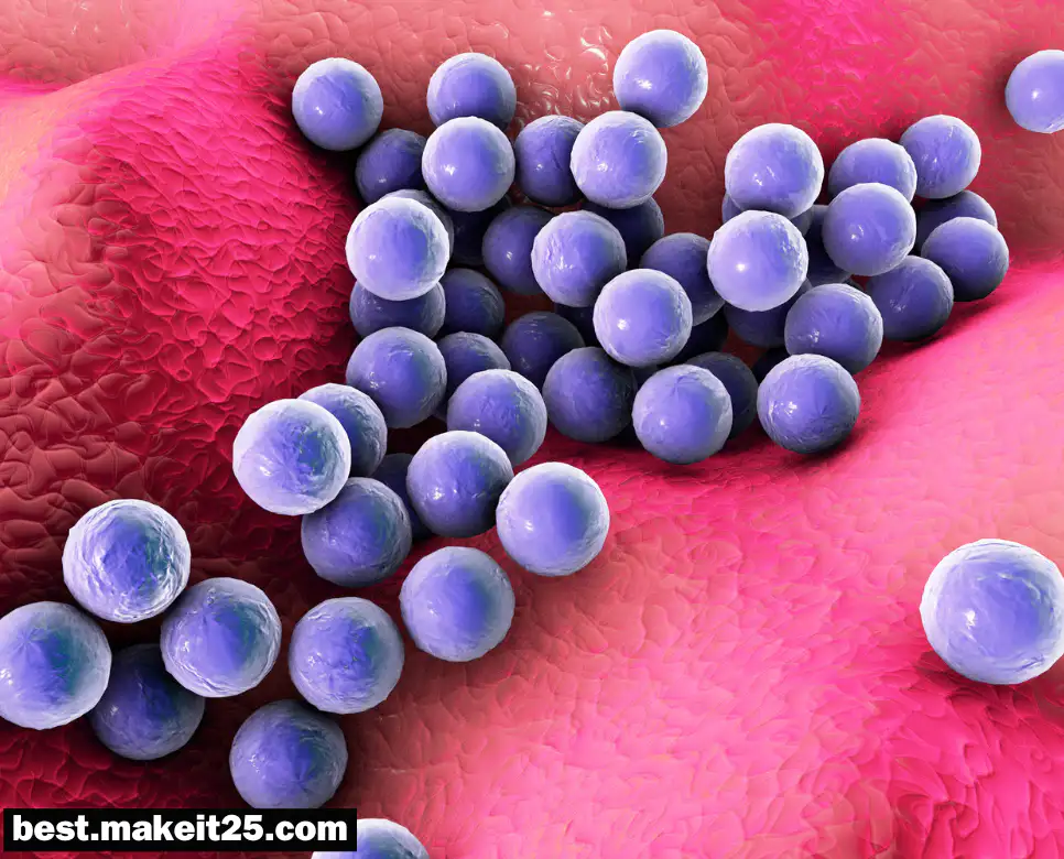 의학용어 MRSA, MRCP, MCL, MBB