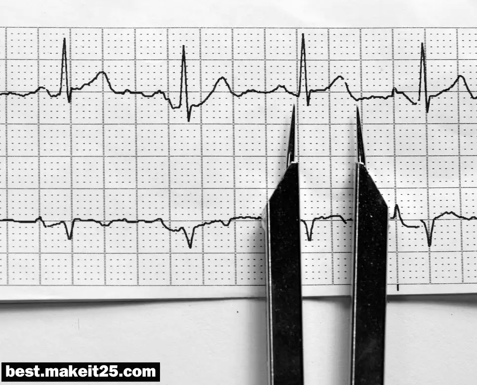 의학용어 NSR, OD, OBS, OU