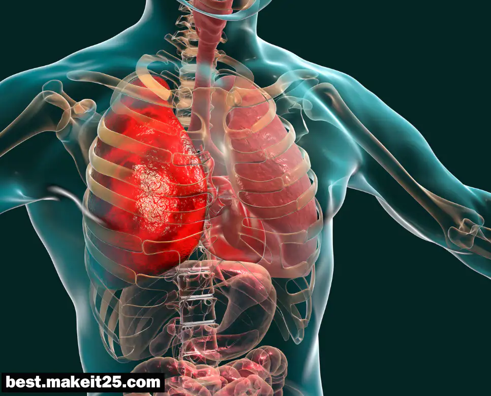 의학용어 PCP, PDF, PDA, PND