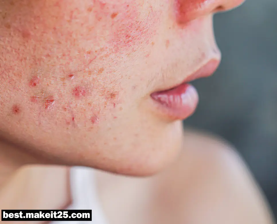 발진 뜻, 식욕부진 뜻, 빈맥 뜻: 제대로 알아보기!