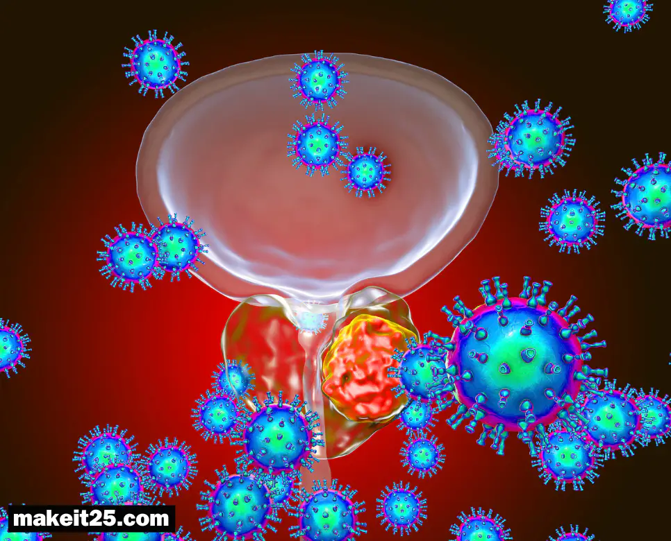 방광암 원인/방광암 초기 증상/방광암에 좋은 음식
