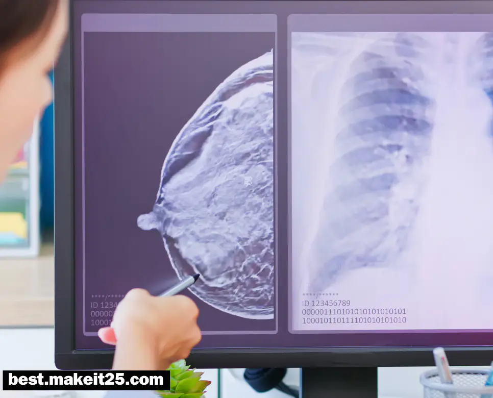 유방암 초기 증상