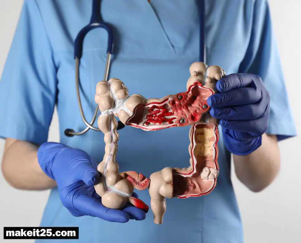 대장암 원인/대장암 초기증상/대장암에 좋은 음식