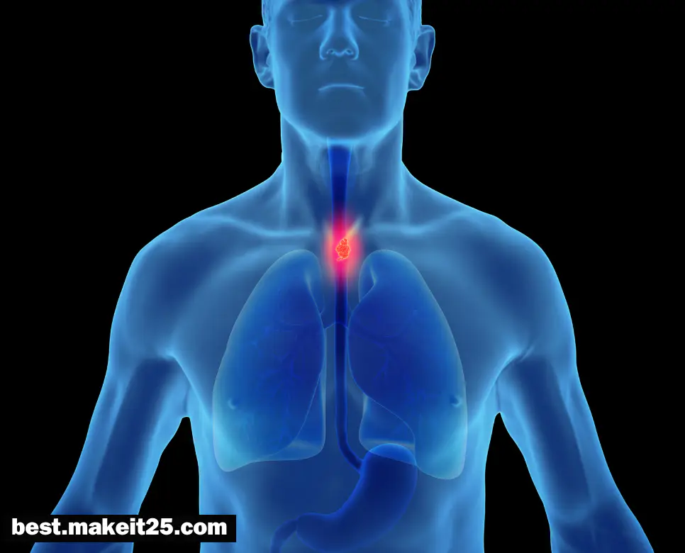 식도암 원인/식도암 초기 증상/식도암에 좋은 음식