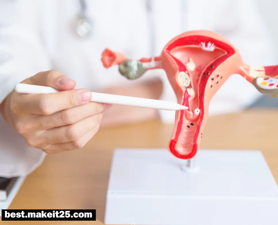 난소암 원인/난소암 초기 증상/난소암에 좋은 음식