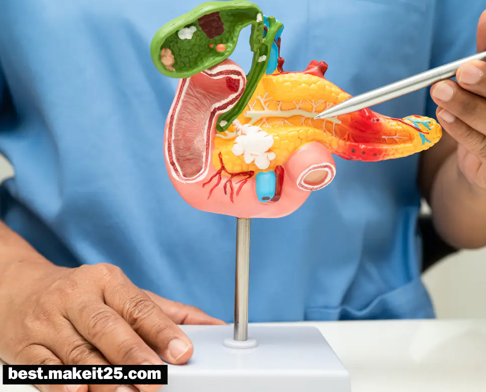 췌장암 원인/췌장암 초기 증상/ 췌장암에 좋은 음식